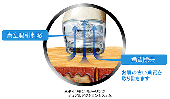 ダイヤモンドチップ